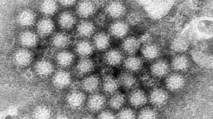 Porast slučajeva norovirusa u Britaniji, najveća opasnost dehidracija organizma