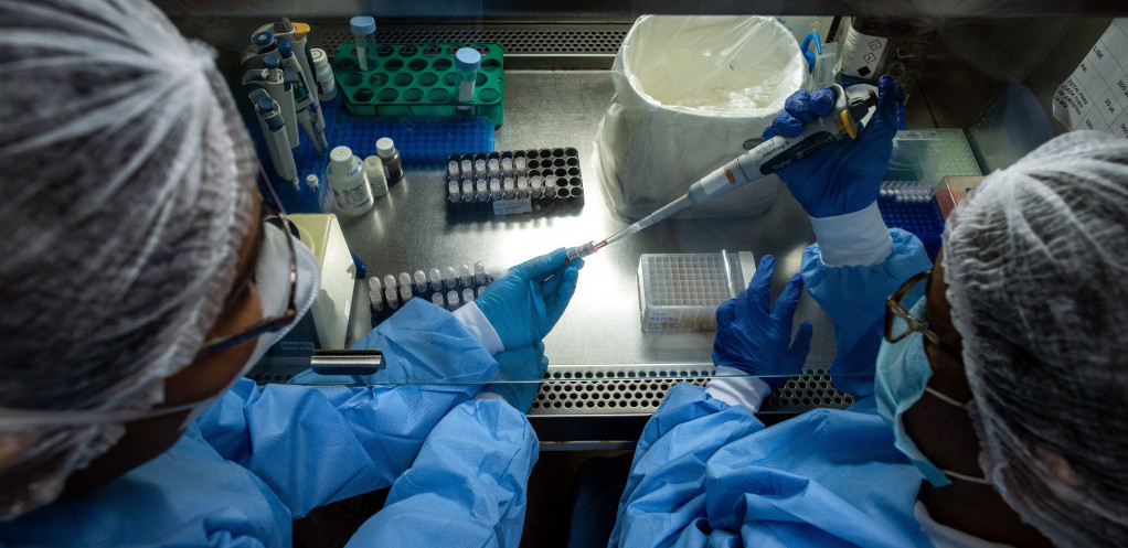Istraživači sa MIT-a otkrili su novi dijagnostički alat koji bi mogao da otrkije ćelije raka u urinu