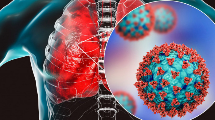 10 posledica koronavirusa koje mogu uticati na dalji tok života