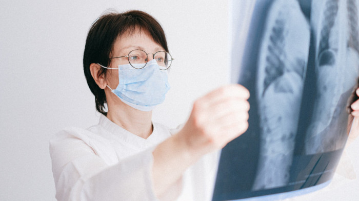 "Imamo redove za operacije za već obolele": Rano otkrivanje bolesti ključno u borbi protiv raka pluća