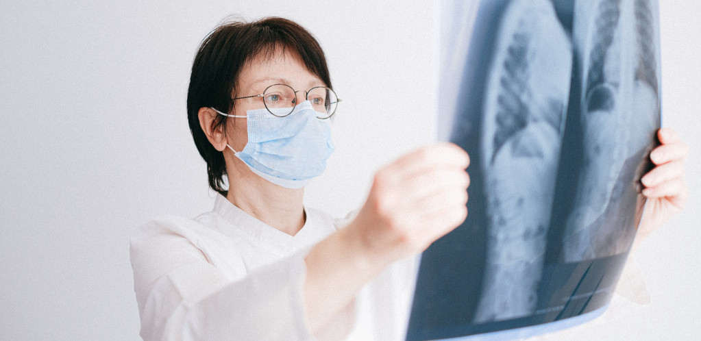 "Imamo redove za operacije za već obolele": Rano otkrivanje bolesti ključno u borbi protiv raka pluća