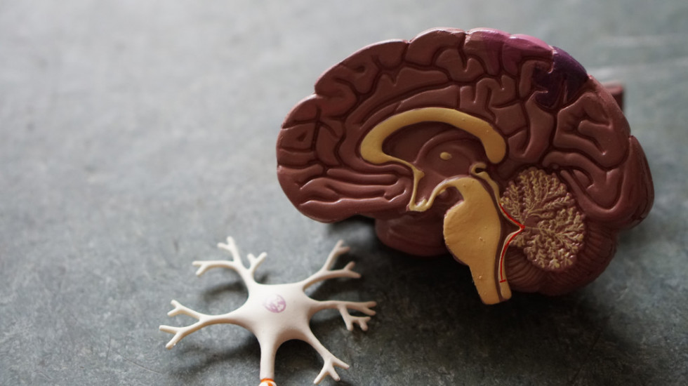 Milioni Evropljana trenutno pate od dugog kovida - istraživači uočili abnormalnosti u mozgu