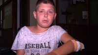 Dečak (13) napadnut kod Vučitrna: Oborili su me na zemlju, šutirali po glavi i telu bez razloga