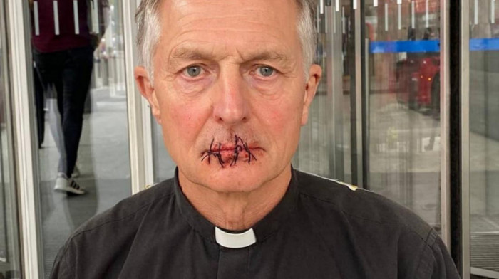 Sveštenik zašio usta kao protest zbog izveštavanja Mardokovih medija o klimatskim promenama