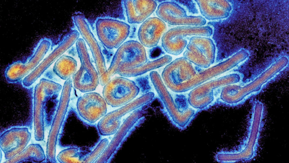 Virus Marburg zabrinuo Gvineju – dr Gligić opisuje kako je izgledalo kada je prvi put izolovan u Beogradu pre pola veka