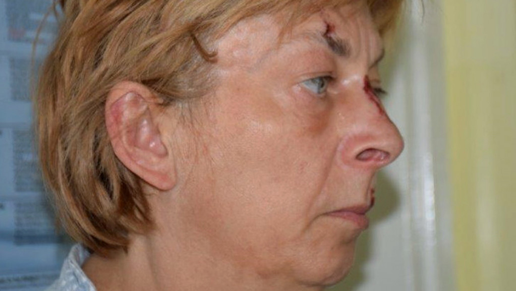 Misterija žene bez pamćenja: Pronađena u Hrvatskoj, priča engleski, a ne zna ko je, ni odakle je