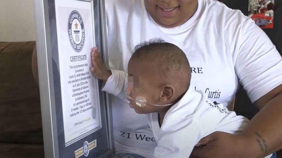 Niko kao on: Dečak iz Alabame, koji je rođen sa 420 grama 19 nedelja pre vremena uspeo da preživi