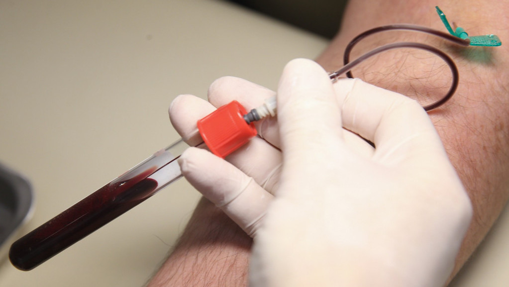 Testiranje na HIV u 24 zavoda za javno zdravlje besplatna tokom cele godine