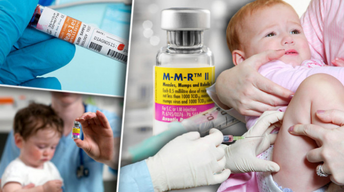 Vreba epidemija opasnih malih boginja: Alarmantne brojke o broju vakcinisane dece MMR-om