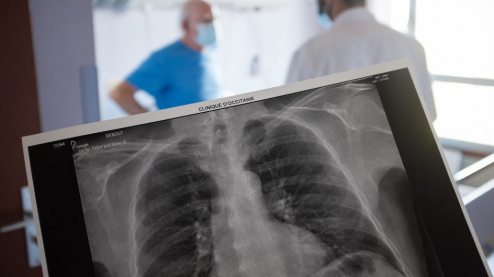 Lečenje postkovid pacijenata – korona najviše posledica ostavlja na pluća i srce, ali nisu retki ni drugi problemi