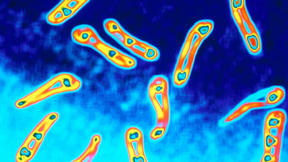 Kompanija Roš pronašla novi antibiotik koji deluje protiv smrtonosne superbakterije