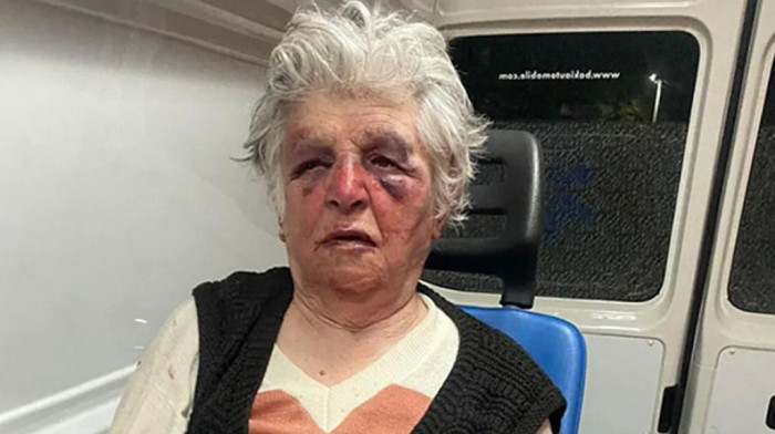 Kancelarija za KiM: Srpkinja brutalno pretučena u svojoj kući u severnom delu Kosovske Mitrovice