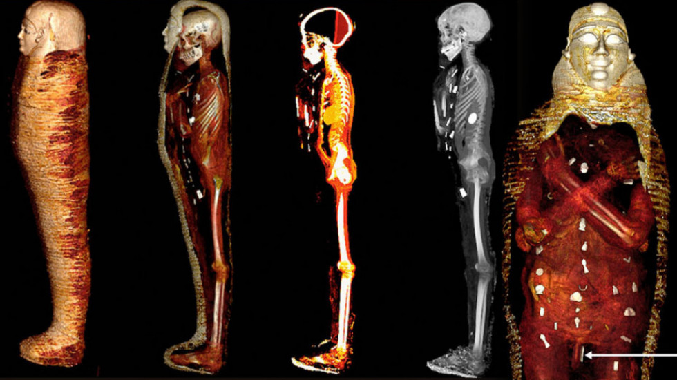 Otkrivene tajne "zlatnog dečaka": Kako je tehnologija iz 21. veka rasvetlila prošlost drevne mumije