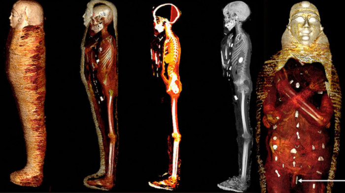 Otkrivene tajne "zlatnog dečaka": Kako je tehnologija iz 21. veka rasvetlila prošlost drevne mumije