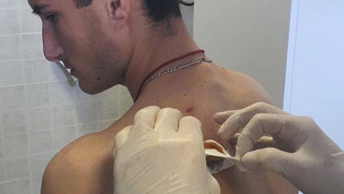 Ranjen dvadesetogodišnji mladić Boban Đuzić iz sela u opštini Klokot sa dve ubodne rane u leđa