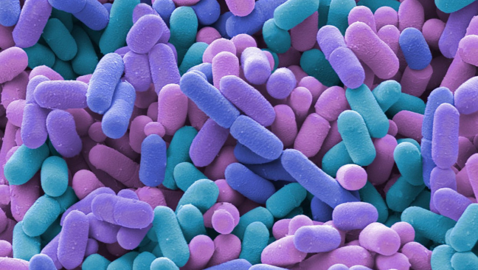 Smrznuti šejkovi najverovatnije izazvali epidemiju listerije u SAD od koje je umrlo 12 ljudi