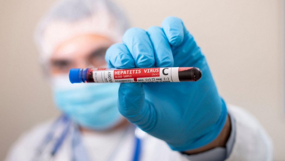U Srbiji 80.000 inficiranih virusom hepatitisa C: Masovno testiranje i oprez jedini način da se bolest svede ne minimum