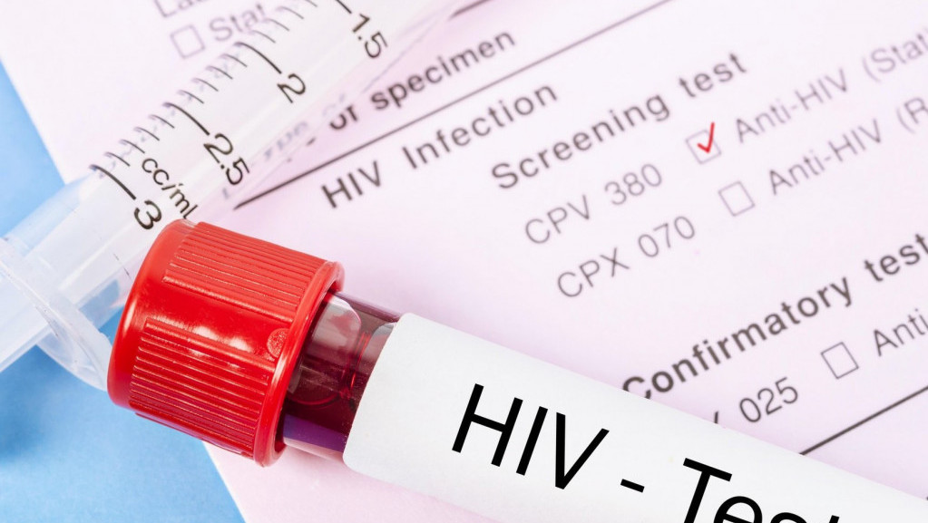 Besplatno savetovanje i testiranje na HIV danas u Zavodu za javno zdravlje