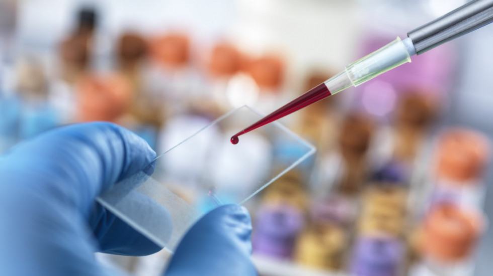 Poziv za nabavku brzih testova za dijagnostiku HIV,sifilisa i hepatitisa do 24. aprila