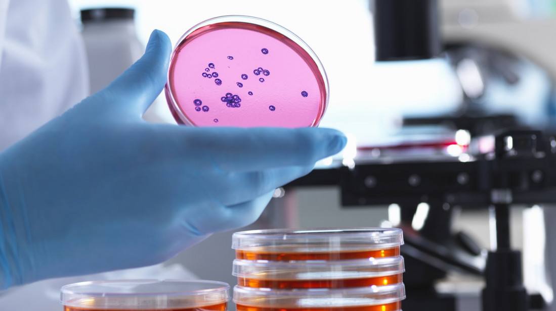 Studija američkog Univerziteta Džons Hopkins : Neke bakterije mogu da prežive kretanje između planeta