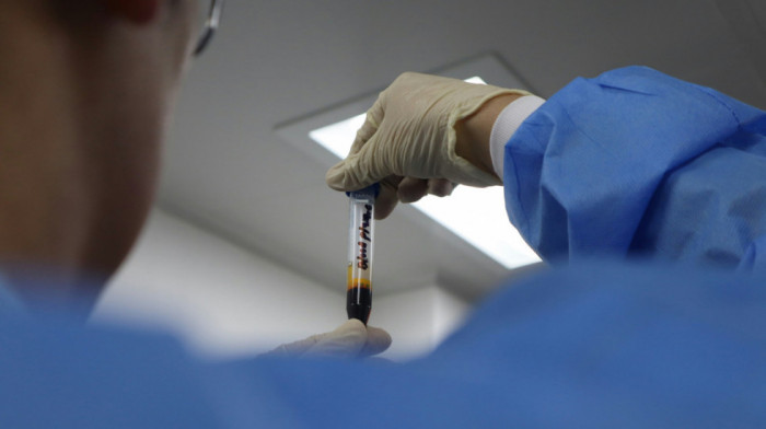 Doktori otkrili da je lek klopidogrel bolji od aspirina u sprečavanju srčanog udara