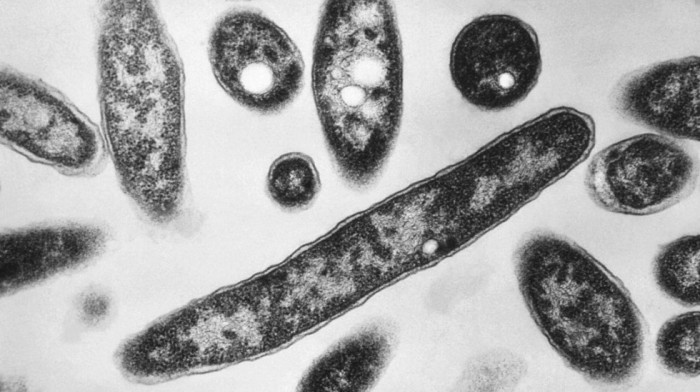 Prvi smrtni slučaj u epidemiji legionarske bolesti u Njujorku