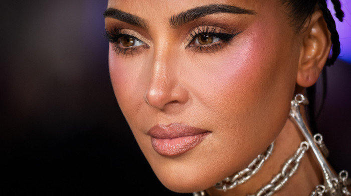 Kim Kardašijan otkrila da ima aneurizmu mozga
