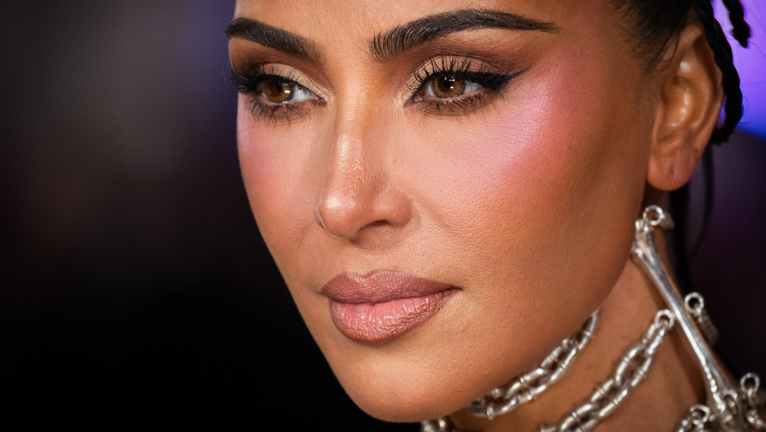 Kim Kardašijan otkrila da ima aneurizmu mozga