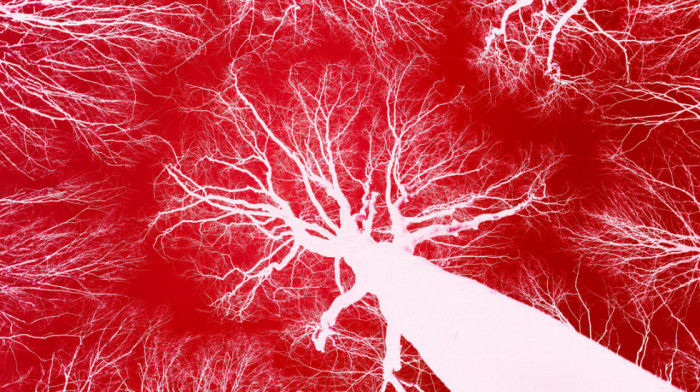 Naučnici razvijaju mikrorobote koji plivaju kroz krv da bi sprečili moždani udar