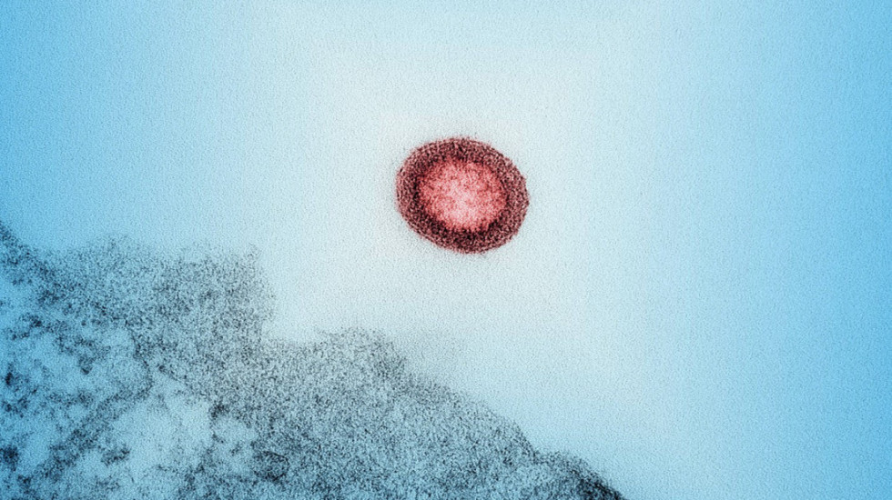 Rusko ministarstvo: Broj HIV infekcija u Rusiji prepolovljen u poslednjih 10 godina