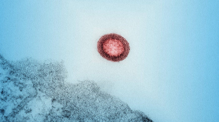 Nemački naučnici otkrili antitelo protiv HIV-a