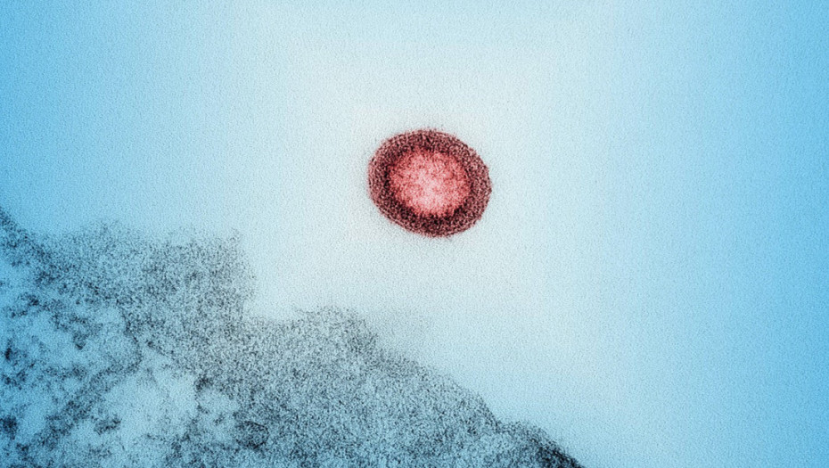 Nemački naučnici otkrili antitelo protiv HIV-a