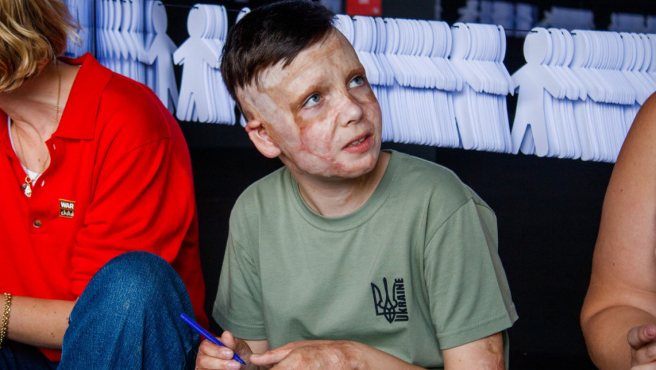 "Bio je to poslednji put da sam video mamu": Potresna ispovest dečaka iz Ukrajine koji je preživeo ruski napad