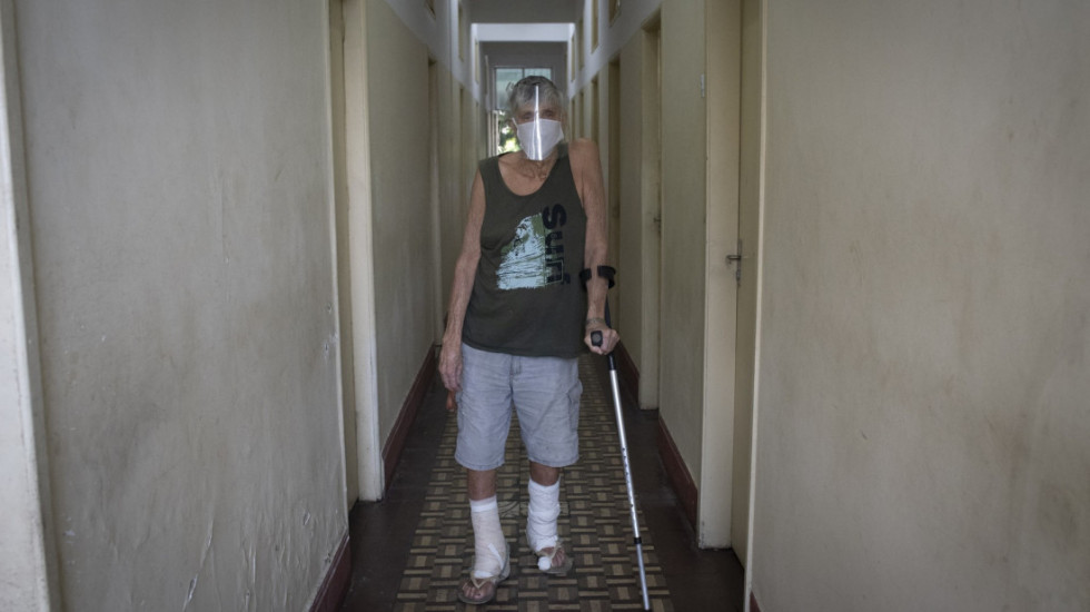 Lepra se vratila u Evropu nakon nekoliko decenija: Ima li Srbija razloga za strah?