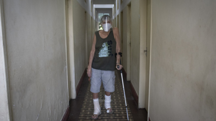 Lepra se vratila u Evropu nakon nekoliko decenija: Ima li Srbija razloga za strah?