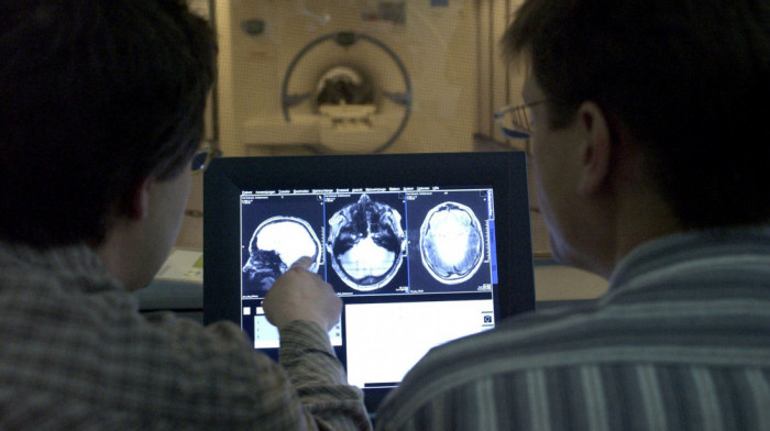 Naučnici otkrili dva nova podtipa multiple skleroze pomoću veštačke inteligencije