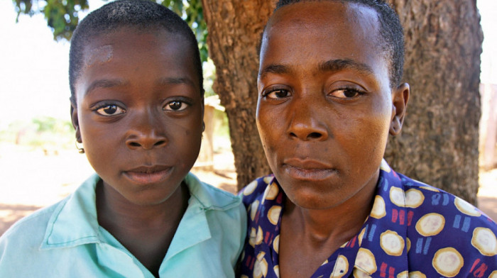 Preminula devojka koja se nekada smatrala “čudom od bebe”: Rođena na drvetu u Mozambiku