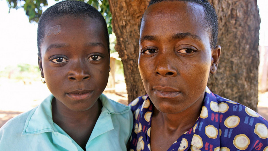 Preminula devojka koja se nekada smatrala “čudom od bebe”: Rođena na drvetu u Mozambiku