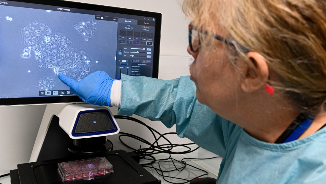 Veliki pomak u borbi protiv raka pankreasa: Inovativni vid lečenja eliminisao tumore kod životinja