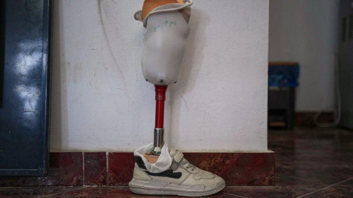 Britanac sam napravio protezu za nogu, uštedeo više od 40.000 evra