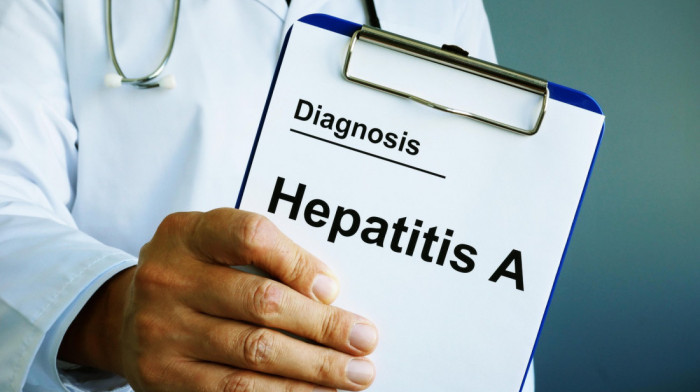 U Napulju za jedan dan potvrđena 84 slučaja hepatitisa A: Broj obolelih u regionu dostigao 150