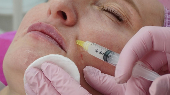 Besplatan botoks u tržnom centru u Nemačkoj, više stotina ljudi čekalo satima u redu