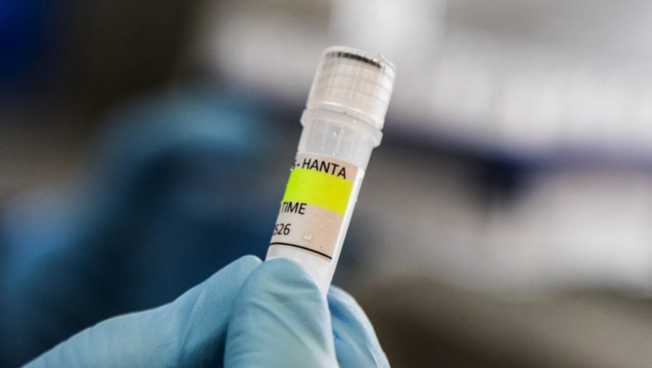 Španski putnik pozitivan na hantavirus stabilno - ostali u karantinu bez simptoma