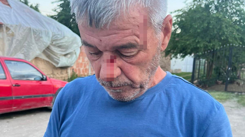 Kancelarija za KiM: Srbin na Kosovu pretučen dok je pokušao da odbrani sina od napadača