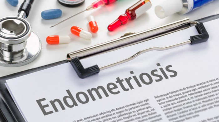 Proboj u medicini: Jednostavan test krvi mogao bi da ubrza otkrivanje endometrioze