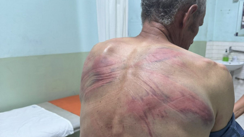 Srpska lista: Kosovska policija Srbina odvela u šumu, vezala za drvo i tukla crevom (FOTO)