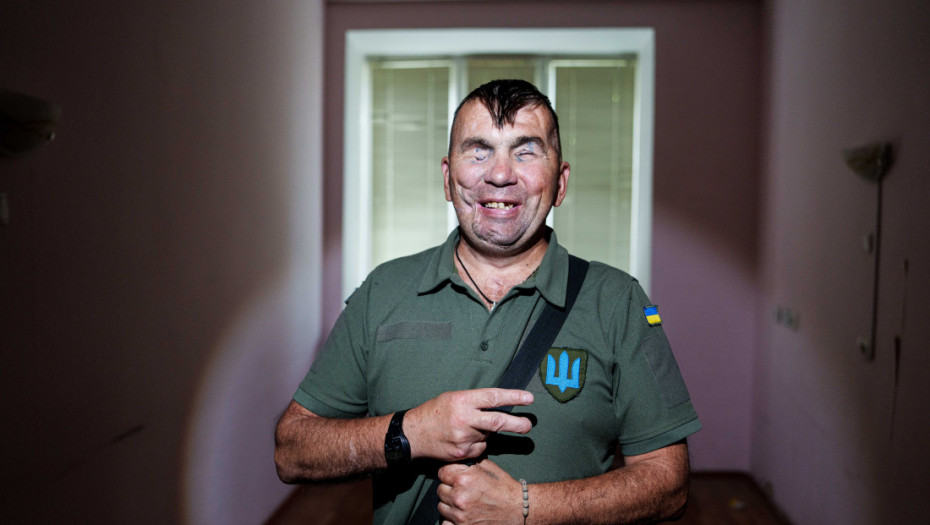 Ukrajinski vojnik na frontu ostao bez vida: Nada se da lekari mogu napraviti čudo (FOTO)